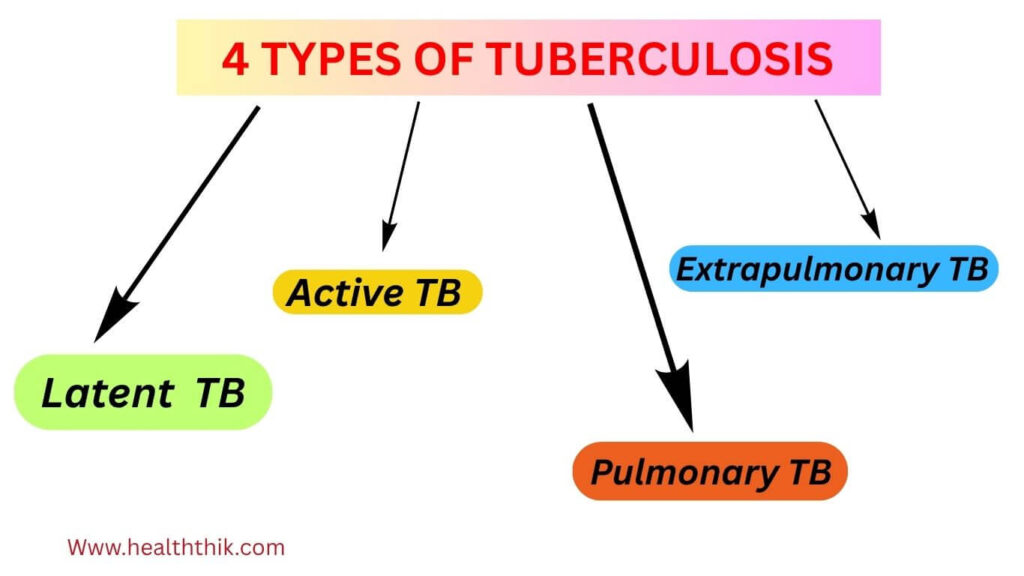 4 TYPES OF TUBERCULOSIS