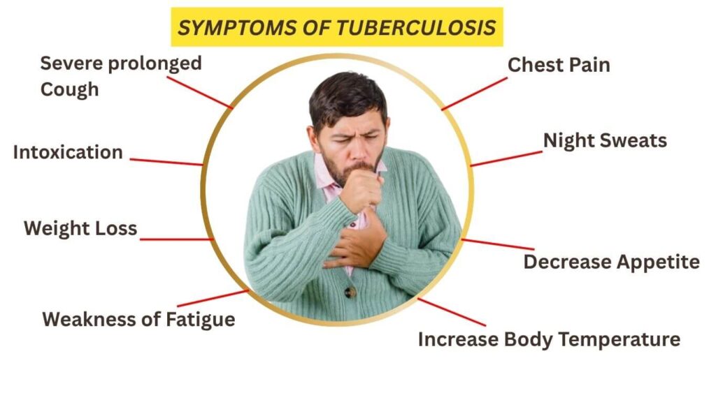 Symptoms of Tuberculosis