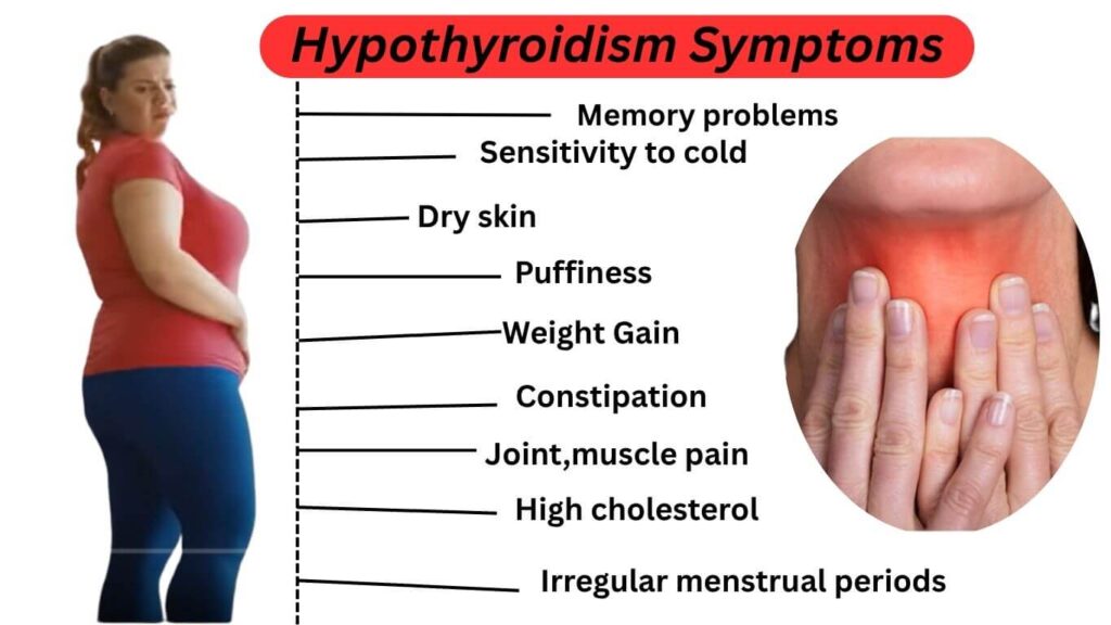 Hypothyroidism