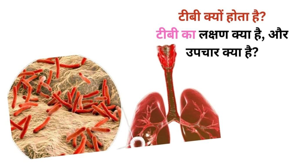 टीबी क्यों होता है? टीबी का लक्षण क्या है, और उपचार क्या है? 