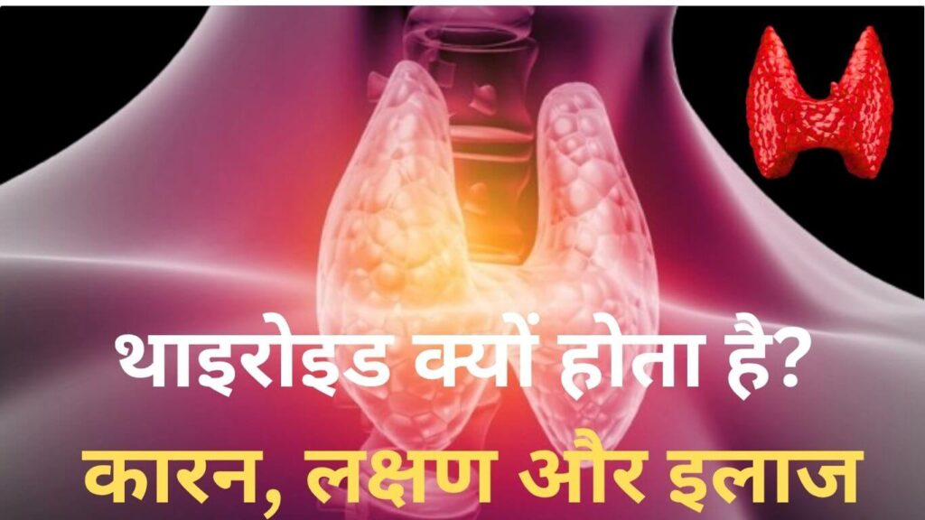  थाइरोइड क्यों होता है? कारन, लक्षण और इलाज